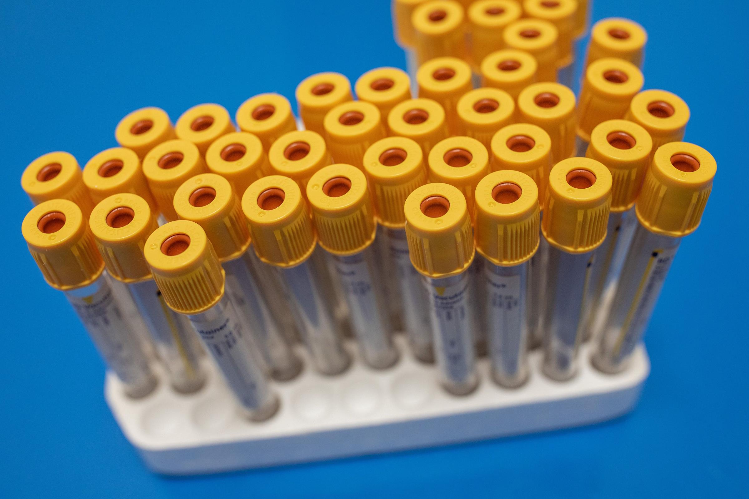 £260 million boost for UK manufacturing and medical research - Vimarsana News